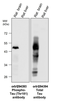 Tau Rabbit Polyclonal Antibody