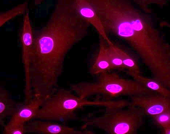 Tau Rabbit Polyclonal Antibody