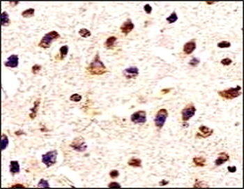 Tau Rabbit Polyclonal Antibody