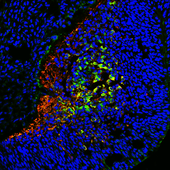 Tau Rabbit Polyclonal Antibody