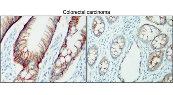NaK ATPase alpha 1 Rabbit Polyclonal Antibody