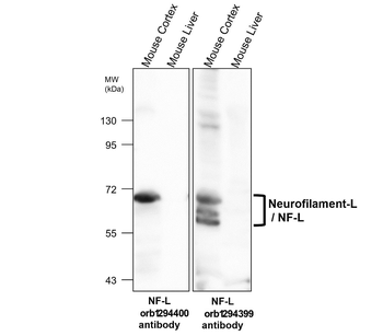 Neurofilament L Rabbit Polyclonal Antibody