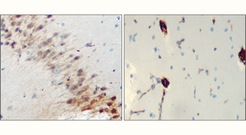 Neurofilament L Rabbit Polyclonal Antibody