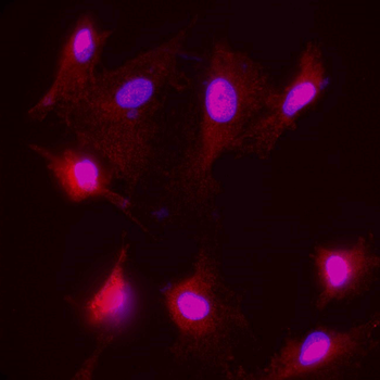 Neurofilament H/NF H Antibody