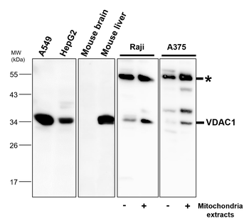 VDAC1 Rabbit Polyclonal Antibody