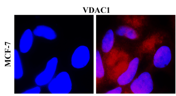 VDAC1 Rabbit Polyclonal Antibody