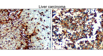 VDAC1 Rabbit Polyclonal Antibody