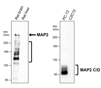 MAP2 Rabbit Polyclonal Antibody