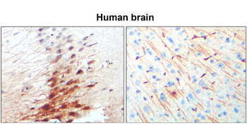 MAP2 Rabbit Polyclonal Antibody