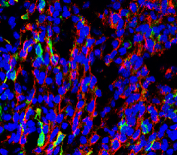 Beta Tubulin 3 Rabbit Polyclonal Antibody