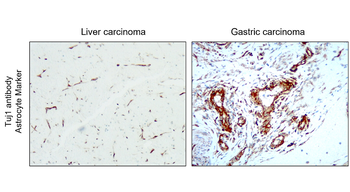 Beta Tubulin 3 Rabbit Polyclonal Antibody