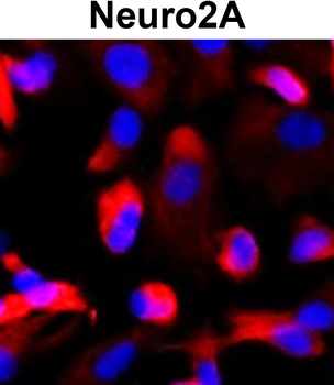 Nestin/NES Antibody