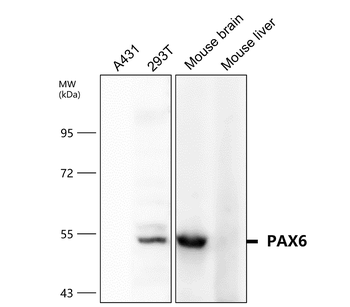 PAX6 Rabbit Polyclonal Antibody