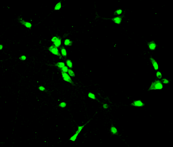 PAX6 Rabbit Polyclonal Antibody