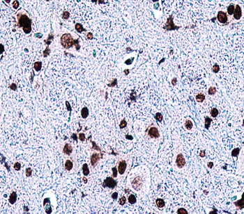 PAX6 Rabbit Polyclonal Antibody