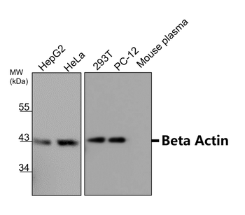 Beta-actin Rabbit Polyclonal Antibody