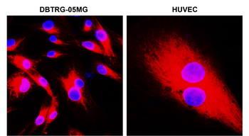 Beta-tubulin Rabbit Polyclonal Antibody