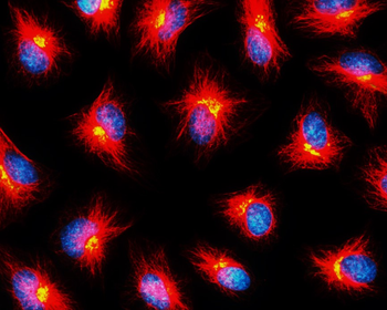 Beta-tubulin Rabbit Polyclonal Antibody