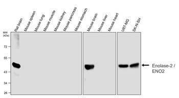 Enolase-2/ENO2 Antibody