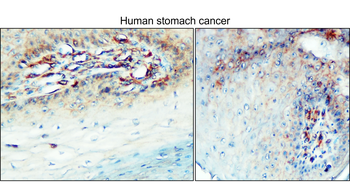 Enolase-2/ENO2 Antibody