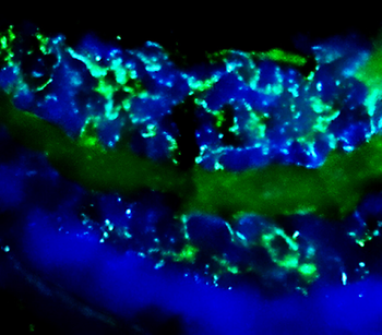 Enolase-2/ENO2 Antibody