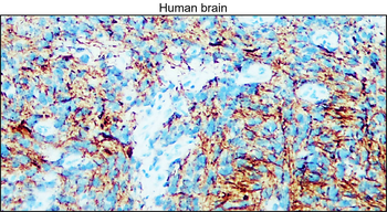 Enolase-2/ENO2 Antibody