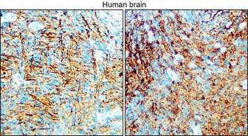 Enolase-2/ENO2 Antibody
