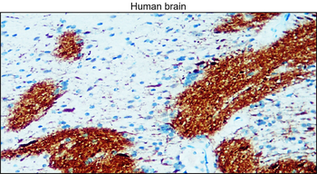 Enolase-2/ENO2 Antibody