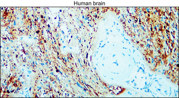 Enolase-2/ENO2 Antibody