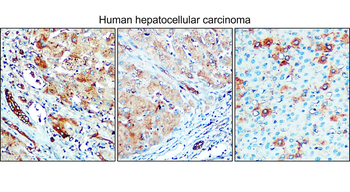 Enolase-2/ENO2 Antibody