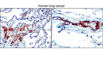 Enolase-2/ENO2 Antibody