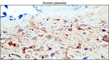 Enolase-2/ENO2 Antibody