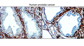 Enolase-2/ENO2 Antibody