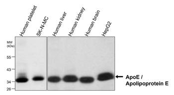 ApoE Mouse Monoclonal Antibody