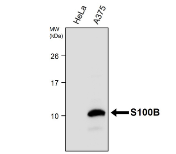 S100B Rabbit Polyclonal Antibody