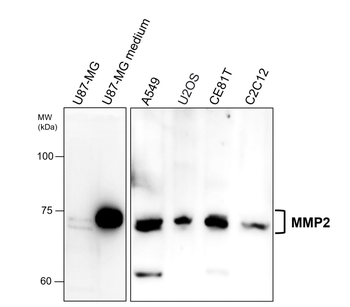 MMP2 c-term Rabbit Polyclonal Antibody