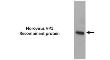 Norovirus VP1 Mouse Monoclonal Antibody