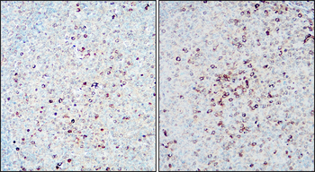 KI-67 Rabbit Polyclonal Antibody