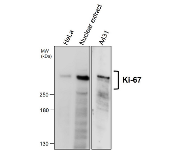 KI-67 Rabbit Polyclonal Antibody