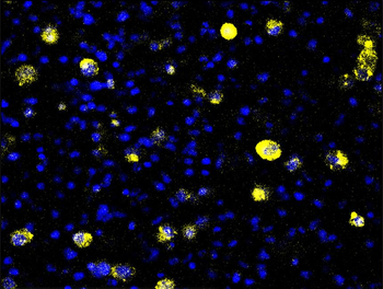 MUC1 Rabbit Polyclonal Antibody