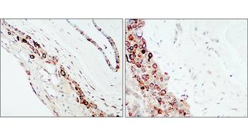 Collagen IV Rabbit Polyclonal Antibody