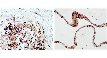 Collagen IV Rabbit Polyclonal Antibody