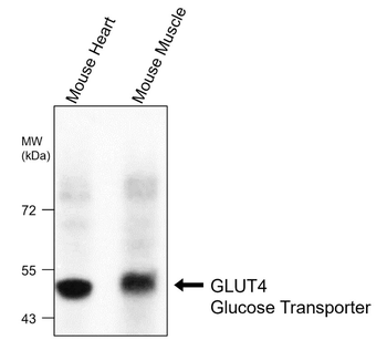 GLUT4 Glucose Transporter Mouse Monoclonal Antibody