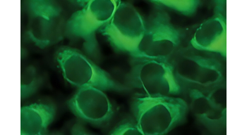 ME1 Mouse Monoclonal Antibody