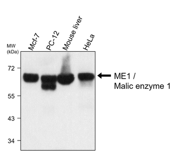 ME1 Mouse Monoclonal Antibody