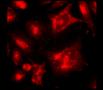 LAMP2 Mouse Monoclonal Antibody