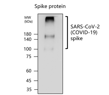 SARS-CoV-2 (COVID-19) Spike protein S2 Antibody