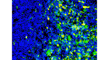 CD8a (mouse specific) Rat Monoclonal Antibody