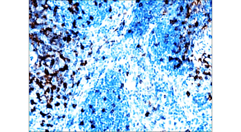 CD8a (mouse specific) Rat Monoclonal Antibody