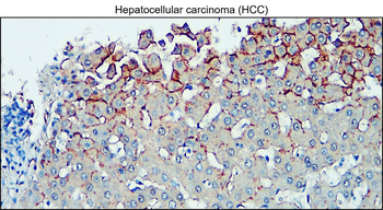 VE-cadherin Rabbit Polyclonal Antibody